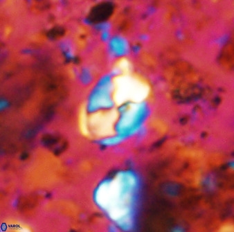 Asapholithos neoanfractus 33601