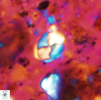 Asapholithos neoanfractus 33601