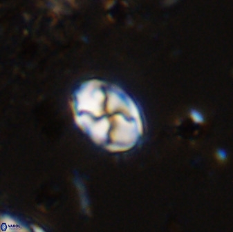 Asapholithos neoanfractus 33615