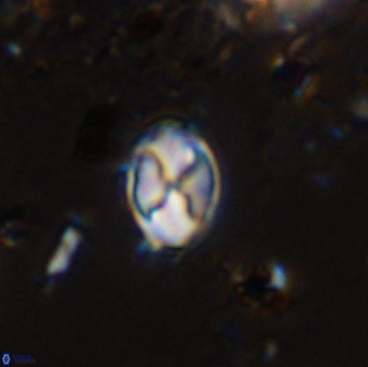 Asapholithos neoanfractus 33616