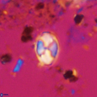 Asapholithos neoanfractus 33617