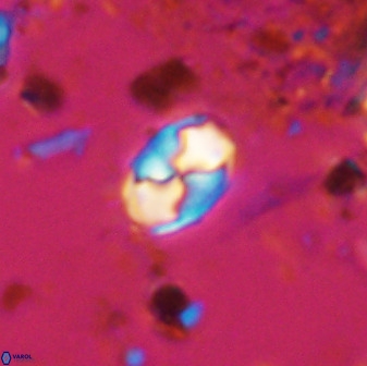 Asapholithos neoanfractus 33618