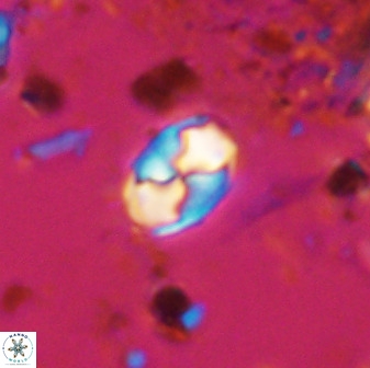 Asapholithos neoanfractus 33618