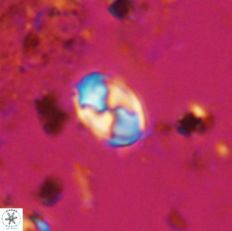 Asapholithos neoanfractus 33613