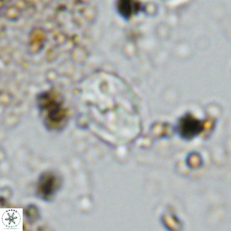 Asapholithos neoanfractus 33625