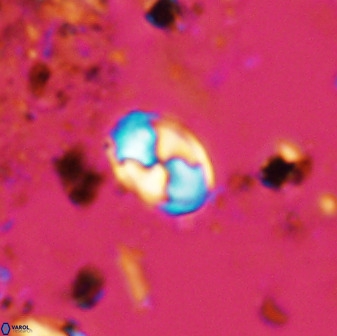 Asapholithos neoanfractus 33628