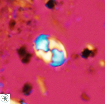 Asapholithos neoanfractus 33628