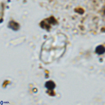 Asapholithos neoanfractus 33620