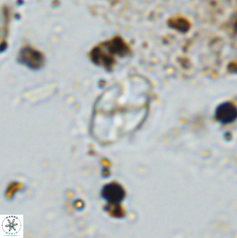 Asapholithos neoanfractus 33620