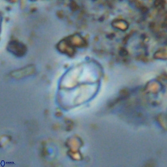 Asapholithos neoanfractus 33621