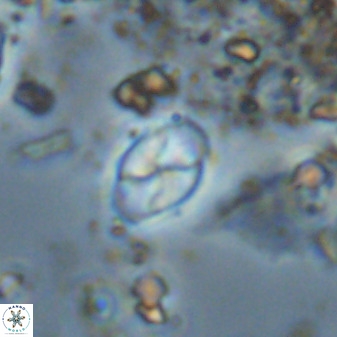 Asapholithos neoanfractus 33621
