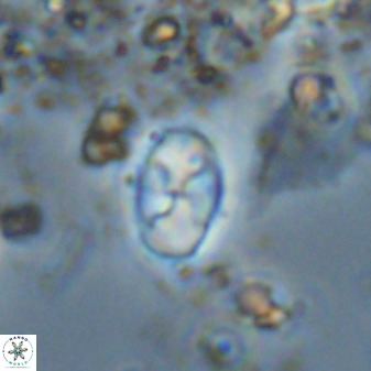 Asapholithos neoanfractus 33622
