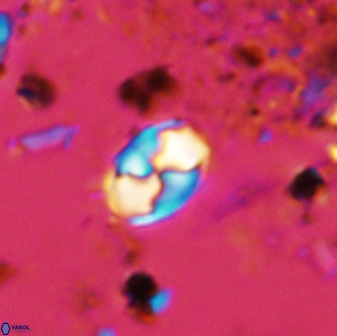 Asapholithos neoanfractus 33631