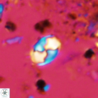 Asapholithos neoanfractus 33631
