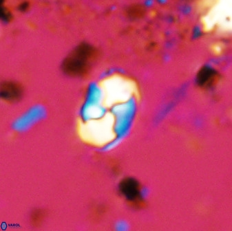 Asapholithos neoanfractus 33632