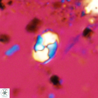 Asapholithos neoanfractus 33632