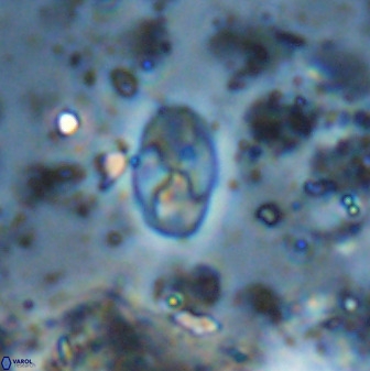 Asapholithos neoanfractus 33835