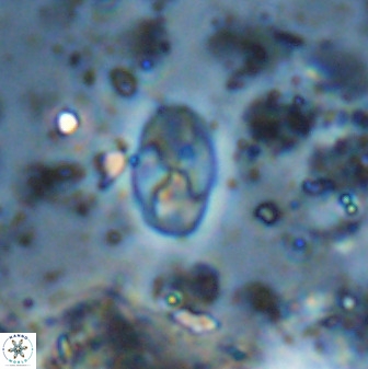 Asapholithos neoanfractus 33835