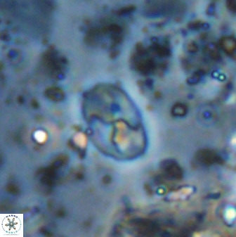 Asapholithos neoanfractus 33836
