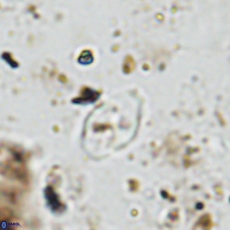 Asapholithos neoanfractus 33838