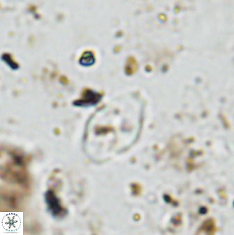 Asapholithos neoanfractus 33838