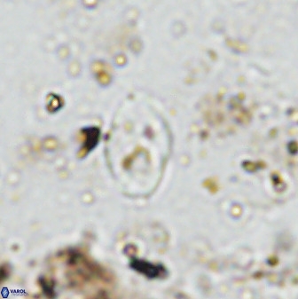 Asapholithos neoanfractus 33839