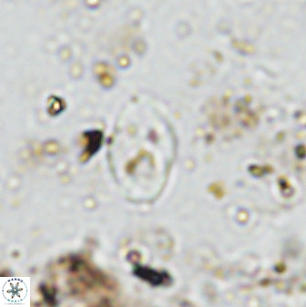 Asapholithos neoanfractus 33839