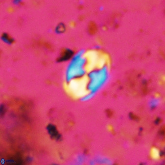 Asapholithos neoanfractus 33845