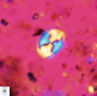 Asapholithos neoanfractus 33845