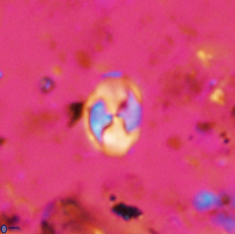 Asapholithos neoanfractus 33841