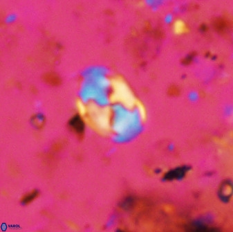 Asapholithos neoanfractus 33842