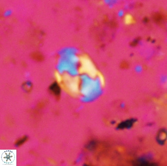 Asapholithos neoanfractus 33842