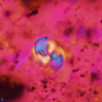 Asapholithos neoanfractus 486