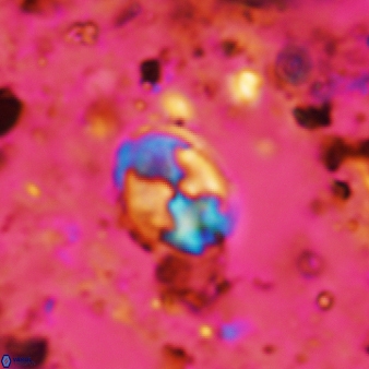 Asapholithos neoanfractus 520