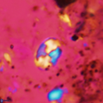 Asapholithos neoanfractus 529