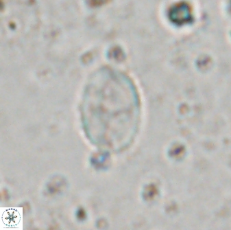 Asapholithos porosuturalis 13514