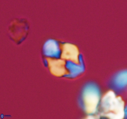 Asapholithos anfractus 10906