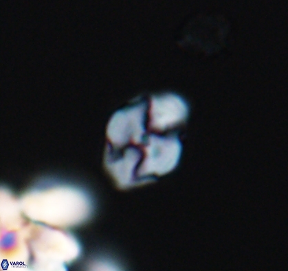 Asapholithus anfractus 10909