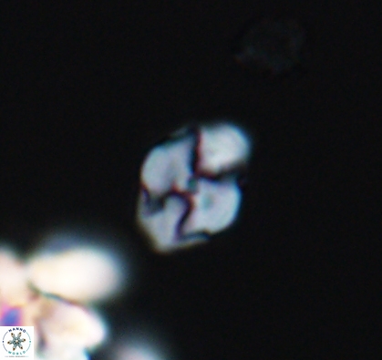 Asapholithus anfractus 10909