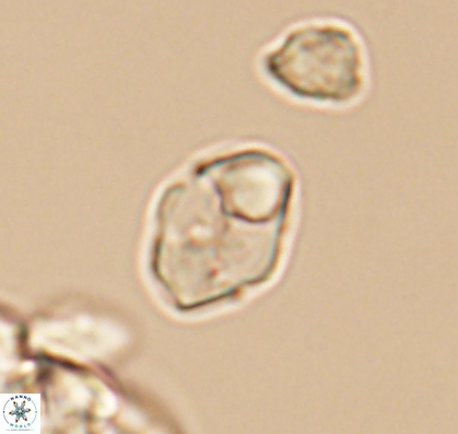 Asapholithus anfractus 10911