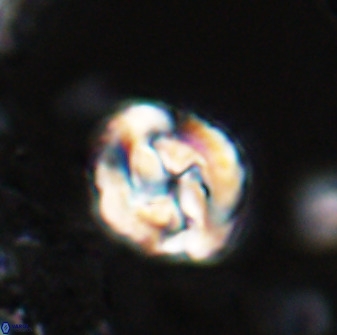 Asinithistimorfi aubryae 25645