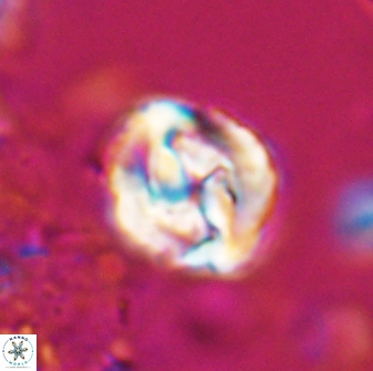 Asinithistimorfi aubryae 25646