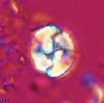 Asinithistimorfi aubryae 25647