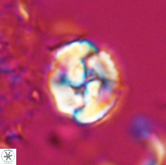 Asinithistimorfi aubryae 25647