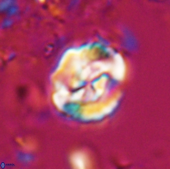 Asinithistimorfi aubryae 25649