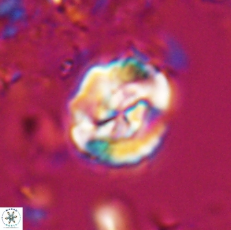 Asinithistimorfi aubryae 25649