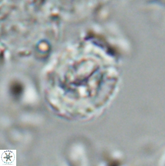 Asinithistimorfi aubryae 25651