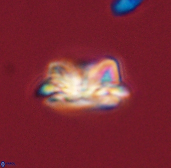 Asinithistimorfi aubryae 57679