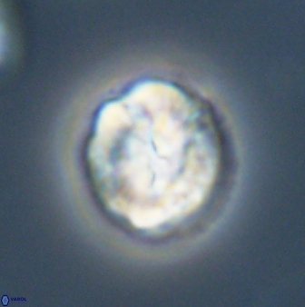 Asinithistimorfi aubryae 57694