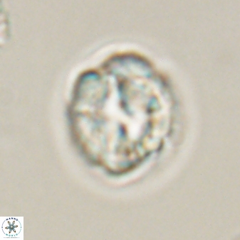 Asinithistimorfi aubryae 57695